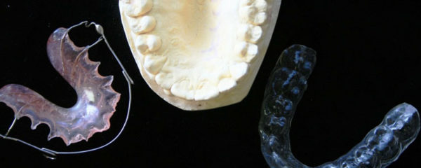 Orthodontie linguale